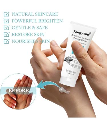 Fengyang Acanthosis Nigricans Cream Anti-Dark Spots Cream Correcting Cream for Elbow Knee Joint - Buy Online on GoSupps.com