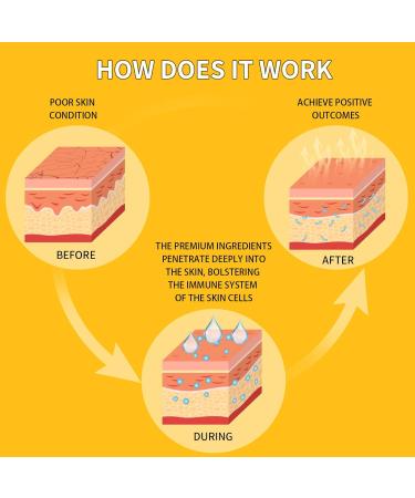 24K Gold Eye Masks for Dark Circles & Puffiness - 70PCS Under Eye Patches with Caffeine Hyaluronic Acid & Peptides for Eye Bags Treatment - Premium Skincare - Buy Online on GoSupps.com