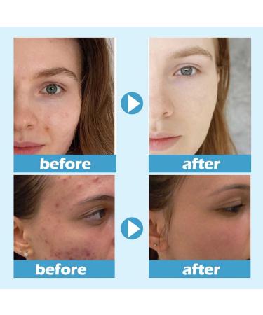  SBTRKT Beauty Hydra Moist Ice Water Night Mask for Face Sleep Mask with Ice Water Moisturising Cream with Hyaluronic Acid Skin Lotion Silky and Not Greasy Reduces Pores - Buy Online on GoSupps.com