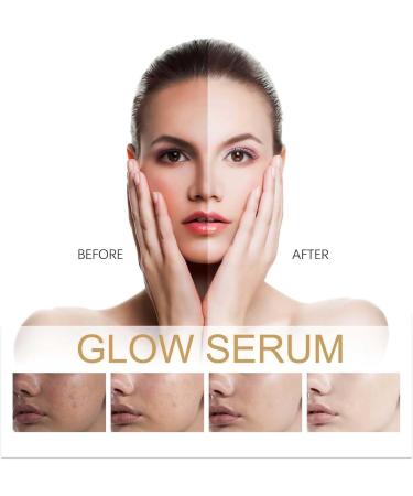 S rum la niacinamide - Essence hydratante pour le visage - 10 % niacinamide + 1 % de zinc - Convient pour tous les types de peau - 30 ml - Buy Online on GoSupps.com