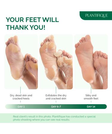 Men's Foot Peel Mask - Dermatologist Tested for Baby Soft Feet - Exfoliating & Repairing Dry Cracked Heels - 2 Pack - Buy Online on GoSupps.com