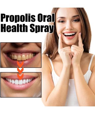 Propolis Oral Health Spray - Fresh Breath | Buy 3 Pack for International Shipping - Buy Online on GoSupps.com
