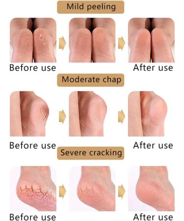 Moisturizing Heel Socks - Heel Socks for Dry Cracked Feet Gel Heel Repair Socks for Cracked Heels Moisture Socks for Women Dry Feet Moisturizing Spa Socks for Overnight Dark Gray - Buy Online on GoSupps.com