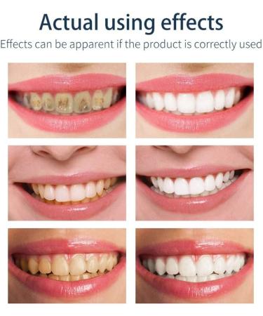 Toothed Foam Adult Cleaning Mousse Toothpaste | Deep Cleaning Oral Hygiene Foam | 100g Tooth Mousse for Plaque Removal - International Shipping - Buy Online on GoSupps.com