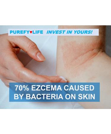 PUREFY Baby Dermal Eczema Spray (4oz 2pk) | Natural Healing for Babies | Dermatologist Recommended - Buy Online on GoSupps.com