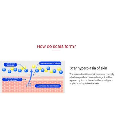 Scar Repairing Gel with Easy-to-Use Soft Texture Plant Extract Ingredients for Refreshing Skin - Reduces Scars & Spots - 30g/1.1oz - Buy Online on GoSupps.com