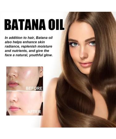 Batana Oil For Hair Growth Natural Organic For Healthy Hair Improves Hair And Skin Radiance Leaves Your Hair Smoother Christmas Gifts (2 Pcs) - Buy Online on GoSupps.com