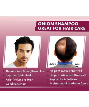 UrbanGabru Red Onion Shampoo for Hair Growth & Hairfall Control | 6.76 fl oz | Best International Shipping - Buy Online on GoSupps.com