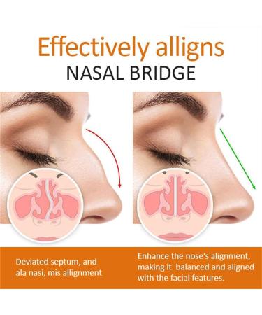 BaBound Liftx Nose Defining Serum SciEffect Nose Lift Shaping OilNasal Bone Remodeling Serum Nose Lift Shaping Oil Nose Lift Up Shaping Essence Oil 1PCS - Buy Online on GoSupps.com