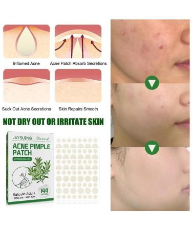 Tea Tree Oil Hydrocolloid Acne Pimple Patches - Waterproof Moisturizing & Invisible Makeup - Fade Acne & Skin Marks | International Shipping - Buy Online on GoSupps.com