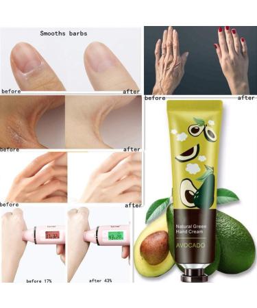 18 Pack Natural Plant Fragrance Hand Cream Gift Set for Dry Cracked Hands - Moisturizing Hand Care with Shea Butter and Aloe | Travel Size Hand Lotion - Buy Online on GoSupps.com