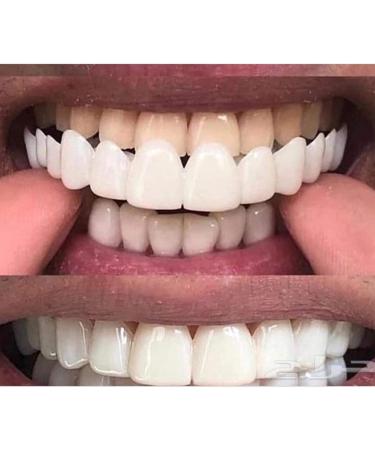 Ytxy Upper & Lower Teeth Veneers - Instant Whitening & Perfect Smile | Cosmetic Dentures & Oral Hygiene Tools - 2 Pairs - Buy Online on GoSupps.com