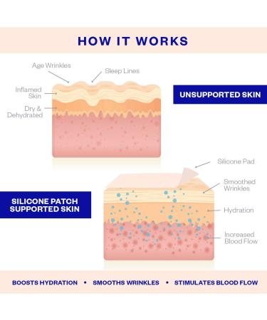Wrinkles Schminkles Forehead & Under Eye Wrinkle Patch Set - Anti-Aging Silicone Patches - Buy Online on GoSupps.com