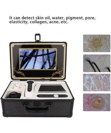 9 Inch LCD Skin Hair Follicle Detector 50X/200X Hair Analyzer 15 Inch Scalp Hair Follicle Detector HD LCD Screen Four Colors Skin Pigment Detector Analyzer - Buy Online on GoSupps.com