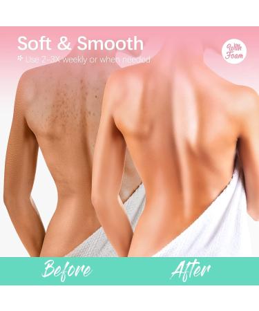 Dr. Pure 10% AHA Body Scrub Set - Natural Exfoliating Sugar Scrub & Cream for Acne, Cellulite, and Scars - Buy Online on GoSupps.com