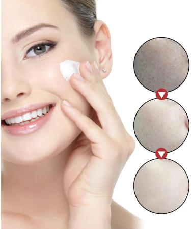 Age Spot Remover for Face Dark Spot Remover for Face & Body Spot Cream Dark Spot Corrector Freckle Remover Cream Dark Spot Correcting Glow Serum Dark Spots Remover Dark Spot Corrector Cream 20 g - Buy Online on GoSupps.com