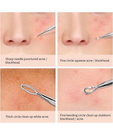 Acne Needle 6 in 1 Acne Blackhead Remover Needle Tools Set Blackhead Tweezer Pimple Extractor Stainless Steel Blackspot Removal (Color : Silver) - Buy Online on GoSupps.com