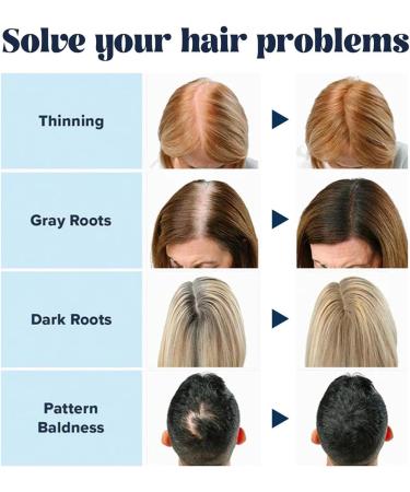 Thick Hair Fiber Powder Colored Hair Thickener Hair Fiber Powder Hair Fibers Refill Enhanced Hair Root Color Powder Hair Fiber Powder for Women & Men (Dark Brown) - Buy Online on GoSupps.com