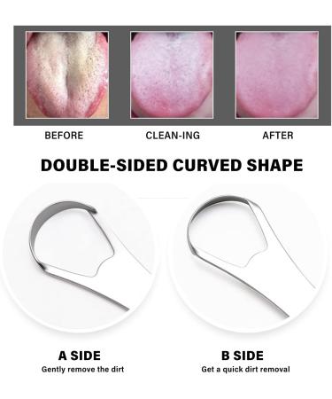 Xiyinli Stainless Steel Tongue Scraper - Double-Sided Curved Tongue Cleaner for Adults & Kids | Reduces Bad Breath & Improves Oral Hygiene - Buy Online on GoSupps.com