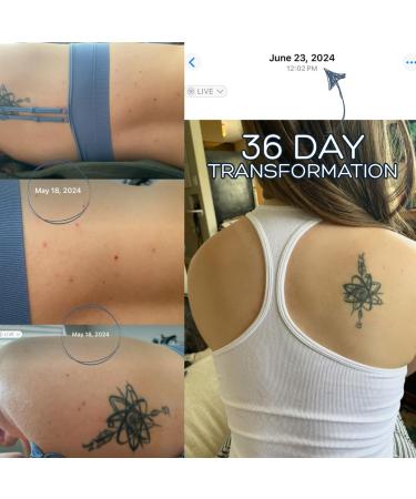 Bacne Wash: All Natural Back Acne Cleanser with Charcoal Jojoba Oil Tea Tree Oil Neem Oil Aloe Vera Colloidal Oatmeal and Vitamin E - Body Acne Wash for All Skin Types - Buy Online on GoSupps.com