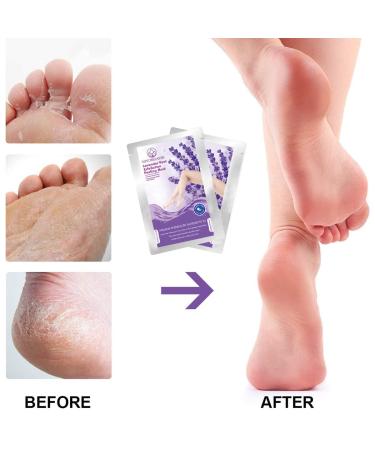  Foot Peeling Mask - Lavender | 2 Pairs for Baby Soft Feet | Repair Dry Skin Calluses & Rough Heels Naturally  - Buy Online on GoSupps.com