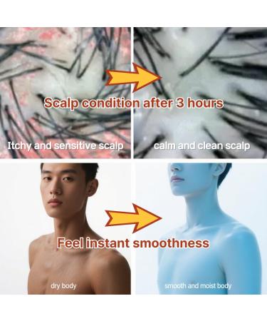 atocaren Calendula Wash Popular Korean All-in-One Cleanser for Scalp Face & Body 100 000ppm Calendula Fragrance-Free Gentle Care for Kids & Adults - Buy Online on GoSupps.com