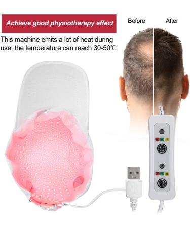 Hair Growth Hat 280pcs Lamp Beads Hair Growth Cap Hair Loss Treatments Helmet for Thinning Hair Hair Regrowth Equipment Oil Control Stimulate Hair Growth System - Buy Online on GoSupps.com