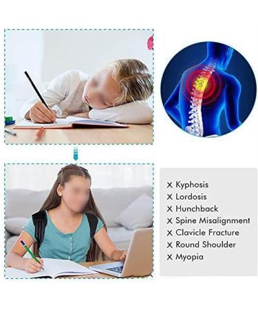 Buy Adjustable Posture Corrector & Back Brace for Adults & Kids - Spinal Support Neck & Clavicle Trainer - Improve Hunching & Bad Posture (Large Black - Buy Online on GoSupps.com