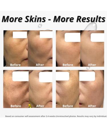 Argireline + Copper Peptides Serum with Bakuchiol & Neck Firming Cream Bundle Face Firming Peptide Serum + Peptide Neck Moisturizer 2 Step Skin Firming Duo - Buy Online on GoSupps.com