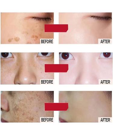 AILKE BOOST LUSTER AILKE 8K Plus Whitening Face Cream Brightening Dark Spot Removal Day and Night Face Cream Deeply Clean Skin with Niacinamide Glutathione Collagen 25g x 2 Pack of 2 2 Pieces - Buy Online on GoSupps.com