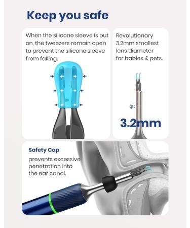 Buy Bebird Note 5 Ear Camera Wax Removal Tool - 10MP Otoscope & 12 Ear Spoons for Effective Ear Cleaning | International Shipping Available - Buy Online on GoSupps.com