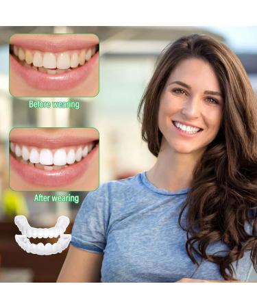 Cosmetic Veneers Teeth - Temporary Repair Kit for Men & Women | Brighten Artificial Teeth & Dentures - Buy Online on GoSupps.com