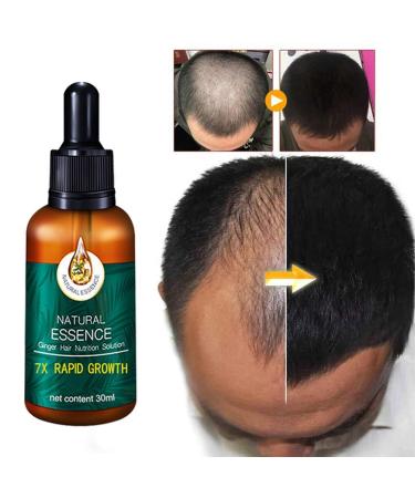 Hair Growth Serum with Ginger Oil - Anti-Hair Loss Thickening & Quick Growth - 30ml for Thinner Hair - Buy Online on GoSupps.com
