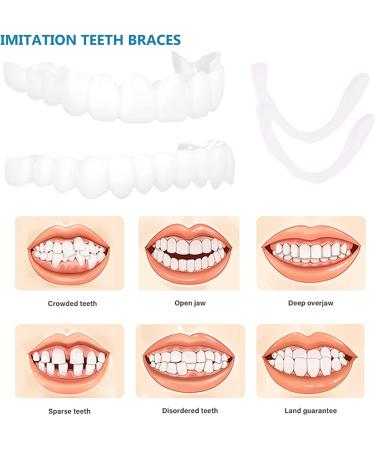 Buy Gimly Teeth Set - Lightening Dentures for Men & Women | Top & Bottom False Teeth 1 Pair - Buy Online on GoSupps.com