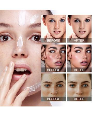 Dark Spot Correcting Serum - Best Dark Spot Remover for Age Spots Sun Spots & Freckles - 30g Body Cream - Buy Online on GoSupps.com