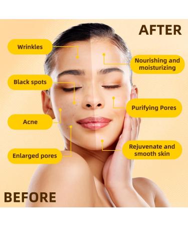 Turmeric Vitamin C Facial Mask with Aloe Vera & Vitamin E - Deep Cleanse Brighten & Moisturize (5.29 oz) | International Shipping - Buy Online on GoSupps.com