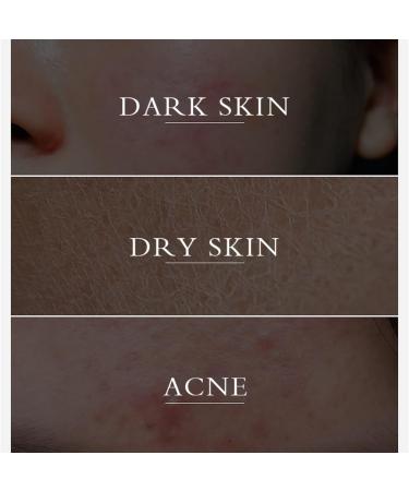 LINEDSON 2PCS Turmeric Face Cream for Face Anti-Aging Cream Face Moisturizer Cream with Organic Ingredients Skin Moisturizing Repair Cream for Dull Dry Skin - Buy Online on GoSupps.com