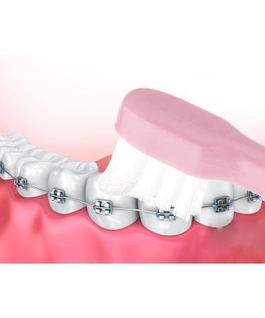 Wllhyf End Tuft Toothbrush Set - Soft Bristle Cleaning for Crowns Bridges & Implants | 4 Pack in White Pink Blue Green | Ideal for Hard-to-Reach Areas - Buy Online on GoSupps.com