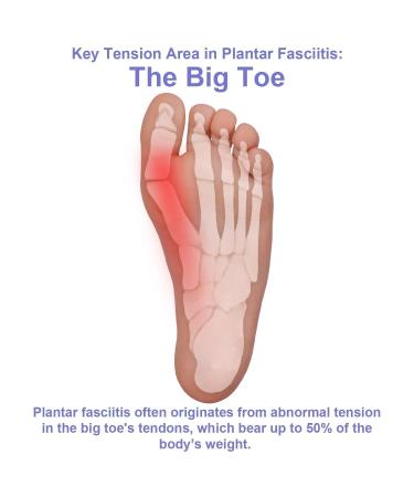 Big Toe Splint for Plantar Fasciitis Relief | Lightweight Toe Support Brace for Men & Women | Pain Solution for Flat Arches Achilles Tendonitis Heel Spurs & Foot Drop - Buy Online on GoSupps.com