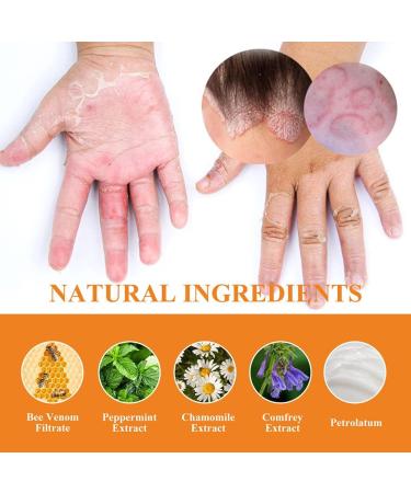RJDJ Bee Venom Psoriasis Treatment Cream - Professional New Zealand Formula for All Skin Types (5PC) - Buy Online on GoSupps.com