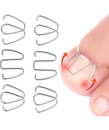 Ingrown Toenail Wire Fixer Ingrown Nail Corrector Iron Rubber Band for Pedicure Foot Care - Buy Online on GoSupps.com
