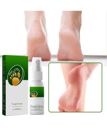 Herbal Foot Spray for Athlete's Feet and Odor Removal | Peeling Foot Care Formula | Eliminates Foot Odor in Shoes & Sports Equipment | 30ml CxC096 - Buy Online on GoSupps.com