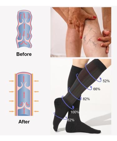 Buy Medical Compression Stockings for Men & Women - 20-30 mmHg Class 2 Closed Toe Graded Support for Varicose Veins & Edema - XL/2X Black - Buy Online on GoSupps.com