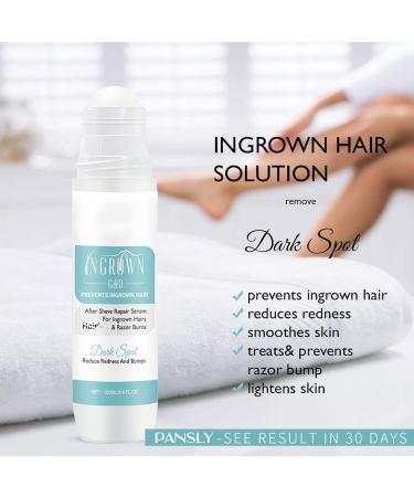 100ml After Trimming Serum for Ingrown Hair | Tend Skin Solution for Arm, Leg, and Back Hair Removal | Man and Woman Care - Buy Online on GoSupps.com