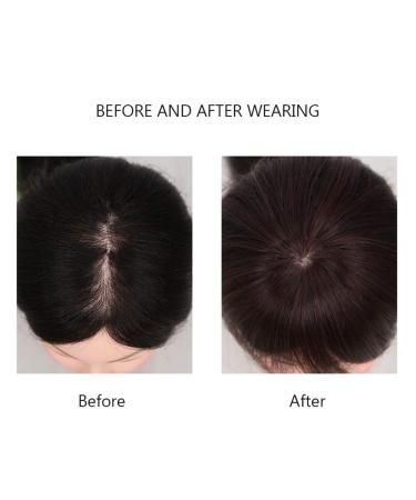 Drasawee Real Hair Topper for Women - Short Dark Brown 7x10 cm for Hair Loss & Thinning Hair - Smooth & Natural Look - Buy Online on GoSupps.com