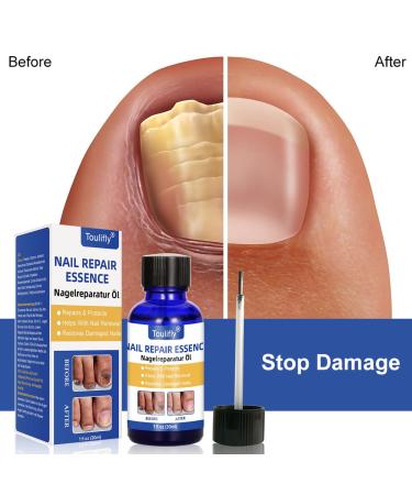 Premium Nail Care & Treatment | Repair Broken & Discolored Nails with Nourishing Nail Oil & Serum for Healthy Hands & Feet - Buy Online on GoSupps.com