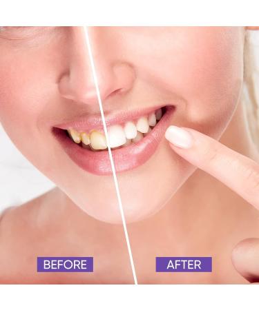 Purple Toothpaste for Teeth Whitening | Blanqueadora Gel for Stain Removal - Adult Tooth Color Corrector - Buy Online on GoSupps.com
