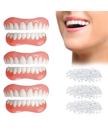 Fake Teeth  6 PCS Veneers Dentures Socket for Women and Men  Dental Veneers for Temporary Tooth Repair Upper and Lower Jaw  Protect Your Teeth and Regain Confident Smile  Bright White W04