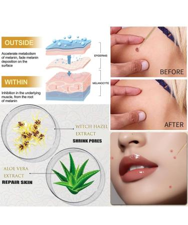 REATIFUL Concentrated Skin Removal Cream - Herbal Formula Ointment for Skin Cleanup (1 set) - Buy Online on GoSupps.com