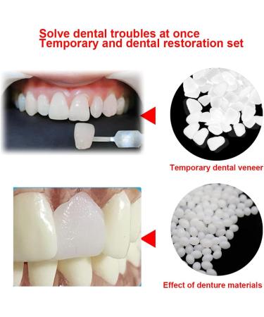 Temporary Tooth Repair Kit - Moldable Fake Teeth & Thermal Fitting Beads for Quick Tooth Replacement | White Teeth Repair Solution - Buy Online on GoSupps.com